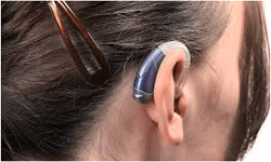 mBTE-Micro-Behind-the-Ear2
